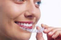 Best Invisalign treatment in Melbourne image 4